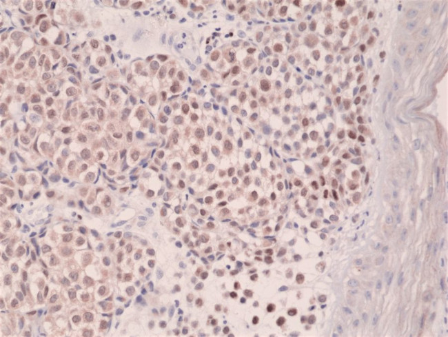 IRF4 Antibody in Immunohistochemistry (Paraffin) (IHC (P))