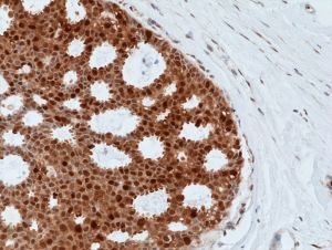 BAG1L Antibody in Immunohistochemistry (Paraffin) (IHC (P))