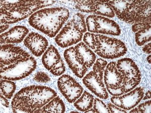 SATB2 Antibody in Immunohistochemistry (Paraffin) (IHC (P))