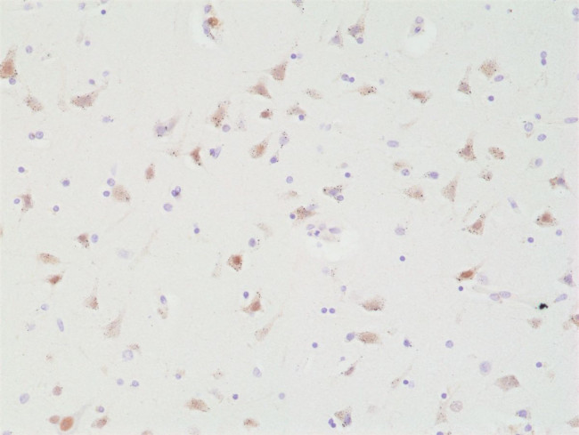 SATB2 Antibody in Immunohistochemistry (Paraffin) (IHC (P))