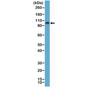 SATB2 Antibody in Western Blot (WB)