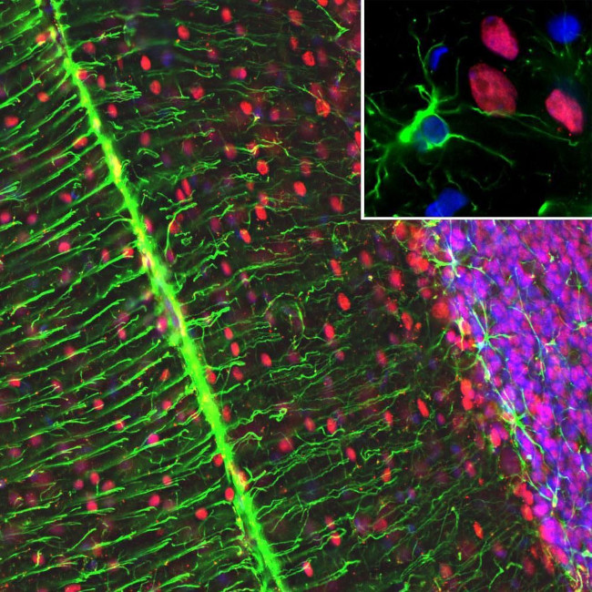 MECP2 Antibody in Immunohistochemistry (IHC)