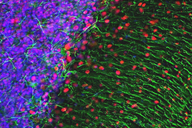 MECP2 Antibody in Immunohistochemistry (IHC)