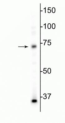 MECP2 Antibody in Western Blot (WB)