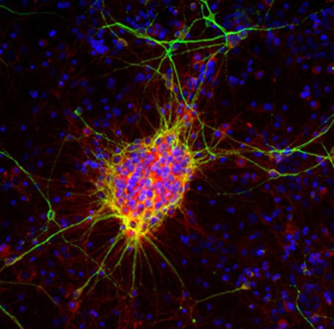 Doublecortin Antibody in Immunocytochemistry (ICC/IF)