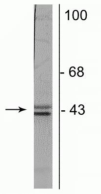 Doublecortin Antibody in Western Blot (WB)