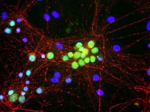 RBFOX1 Antibody in Immunocytochemistry (ICC/IF)