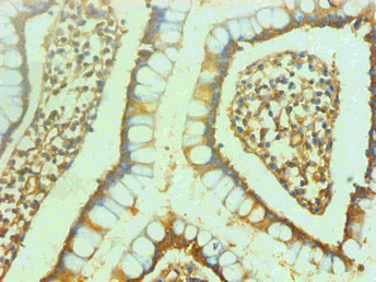 NSE Antibody in Immunohistochemistry (Paraffin) (IHC (P))