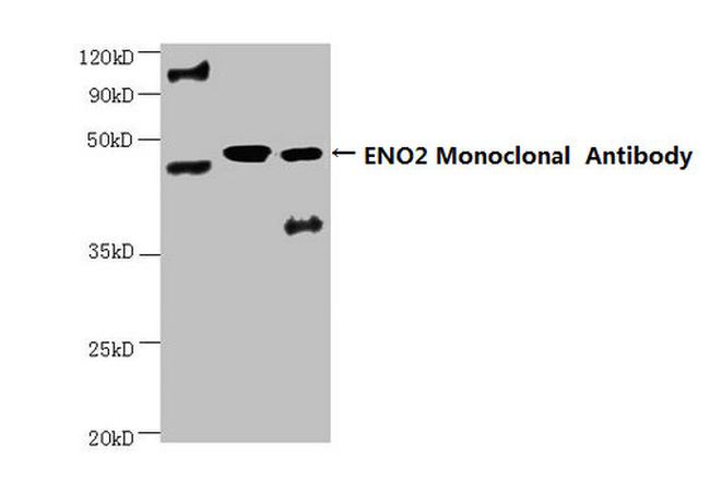 NSE Antibody in Western Blot (WB)