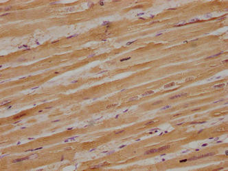 Myoglobin Antibody in Immunohistochemistry (Paraffin) (IHC (P))