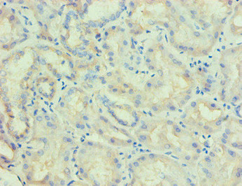 PLA2G7 Antibody in Immunohistochemistry (Paraffin) (IHC (P))