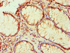 PLA2G7 Antibody in Immunohistochemistry (Paraffin) (IHC (P))