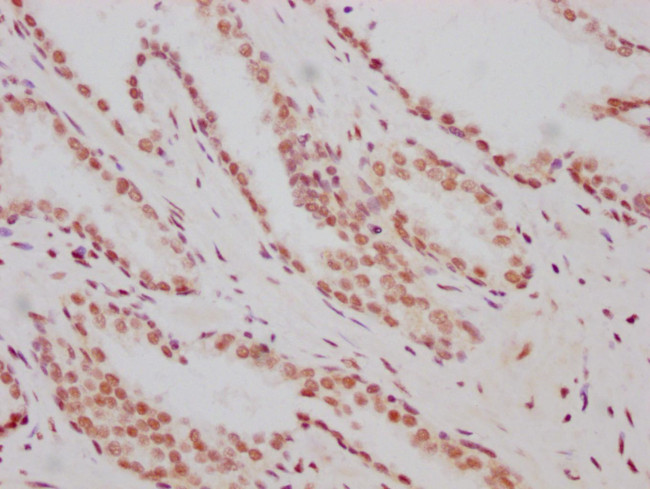 HIF-1 beta Antibody in Immunohistochemistry (Paraffin) (IHC (P))