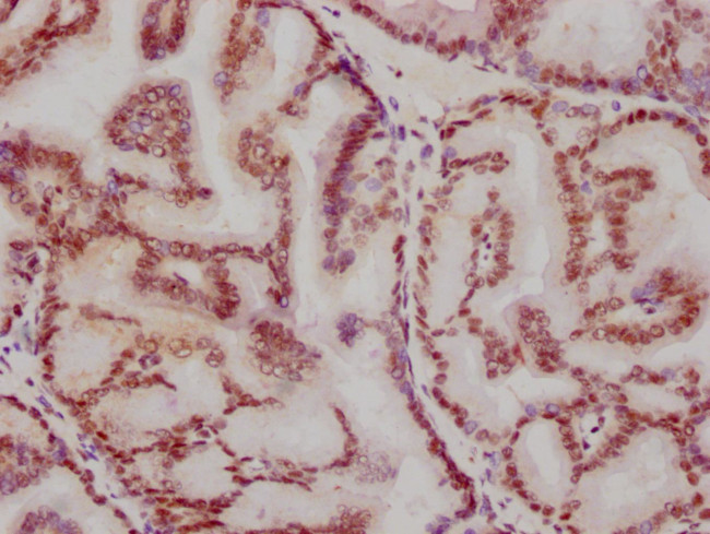 ATF2 Antibody in Immunohistochemistry (Paraffin) (IHC (P))