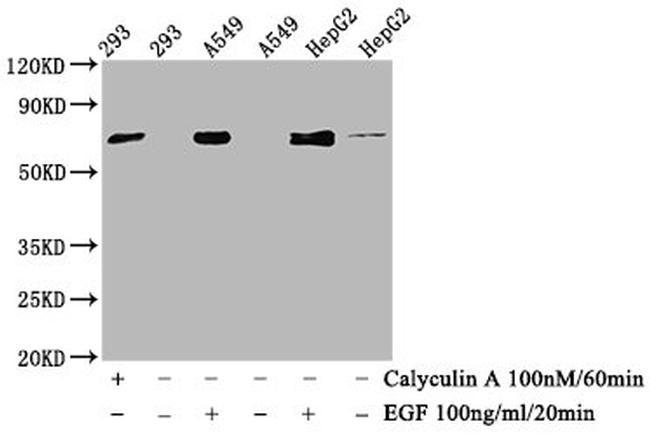 Phospho-ATF2 (Thr71) Antibody in Western Blot (WB)