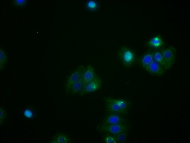 ATF4 Antibody in Immunocytochemistry (ICC/IF)