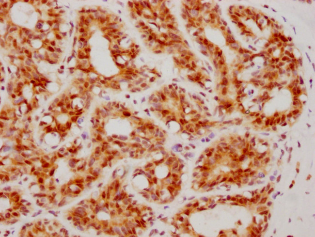 ATF4 Antibody in Immunohistochemistry (Paraffin) (IHC (P))