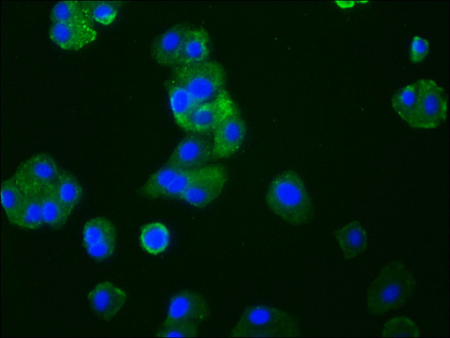 CCR9 Antibody in Immunocytochemistry (ICC/IF)