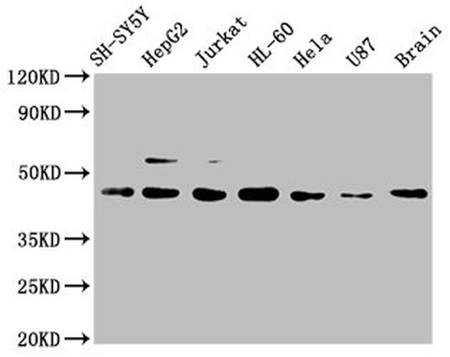 CCR9 Antibody in Western Blot (WB)
