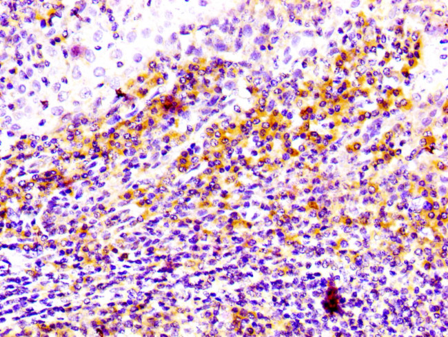 CD81 Antibody in Immunohistochemistry (Paraffin) (IHC (P))