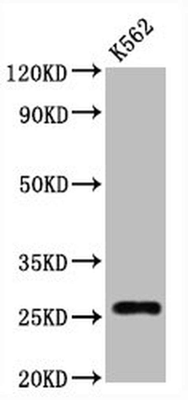 CD81 Antibody in Western Blot (WB)