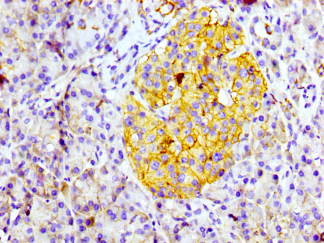 CD99 Antibody in Immunohistochemistry (Paraffin) (IHC (P))