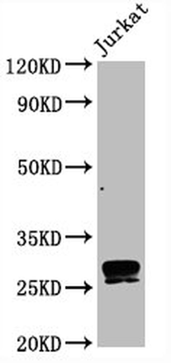 CD99 Antibody in Western Blot (WB)