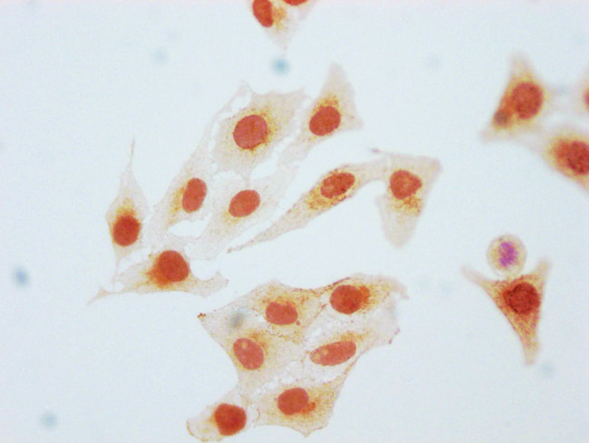 Phospho-CDK2 (Tyr15) Antibody in Immunocytochemistry (ICC/IF)