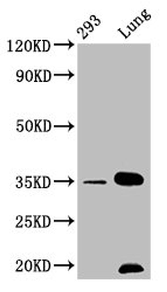 Calponin 1 Antibody in Western Blot (WB)