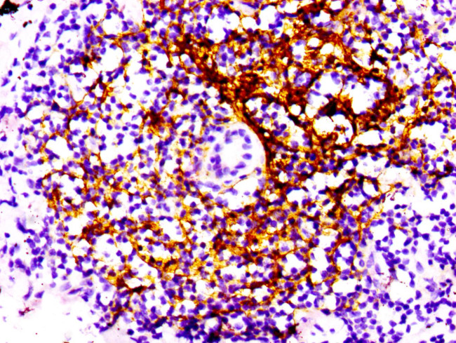 CD21 Antibody in Immunohistochemistry (Paraffin) (IHC (P))