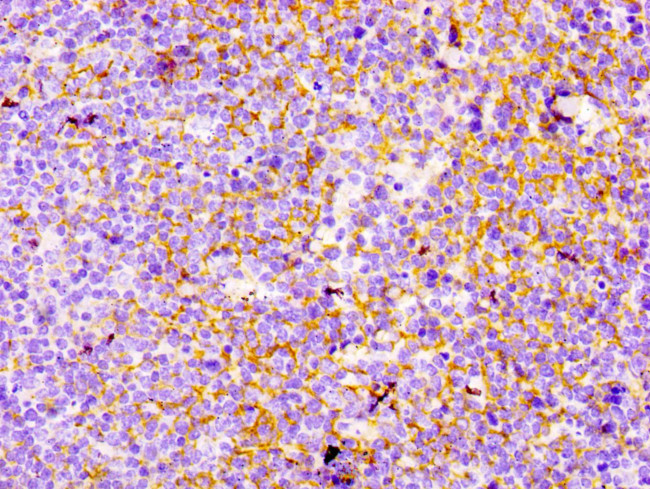 CD21 Antibody in Immunohistochemistry (Paraffin) (IHC (P))