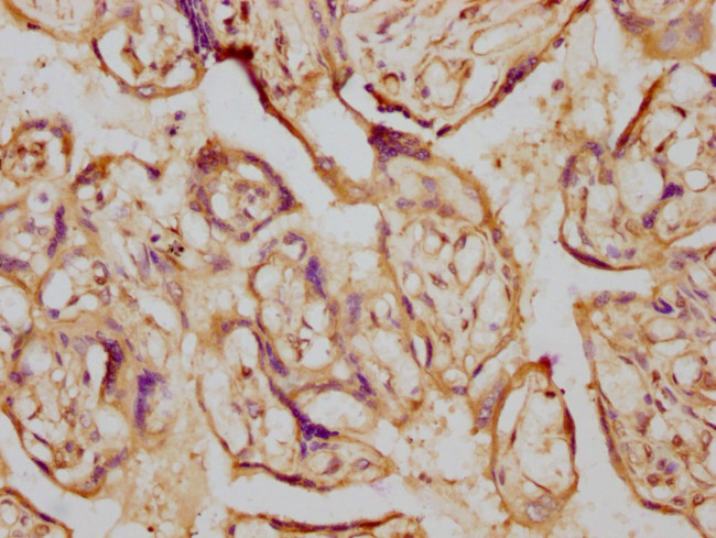 Aromatase Antibody in Immunohistochemistry (Paraffin) (IHC (P))