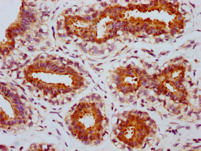 Phospho-mTOR (Ser2448) Antibody in Immunohistochemistry (Paraffin) (IHC (P))