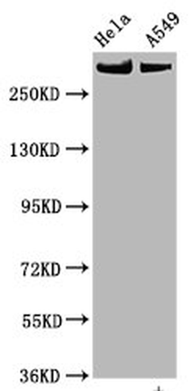 Phospho-mTOR (Ser2448) Antibody in Western Blot (WB)