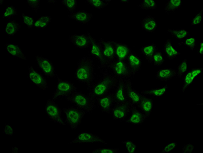 Phospho-mTOR (Ser2481) Antibody in Immunocytochemistry (ICC/IF)