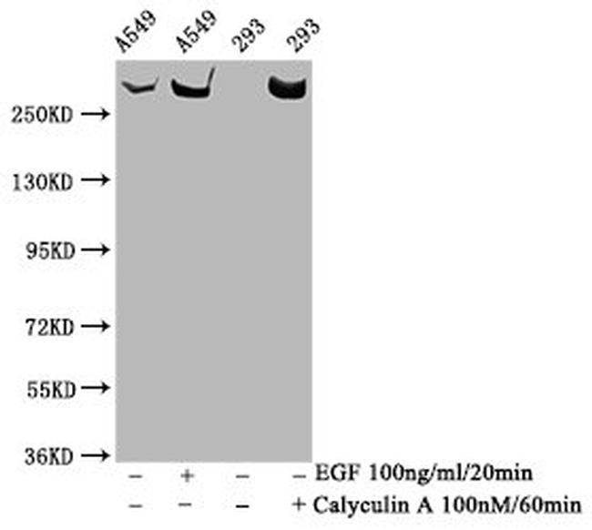 Phospho-mTOR (Ser2481) Antibody in Western Blot (WB)