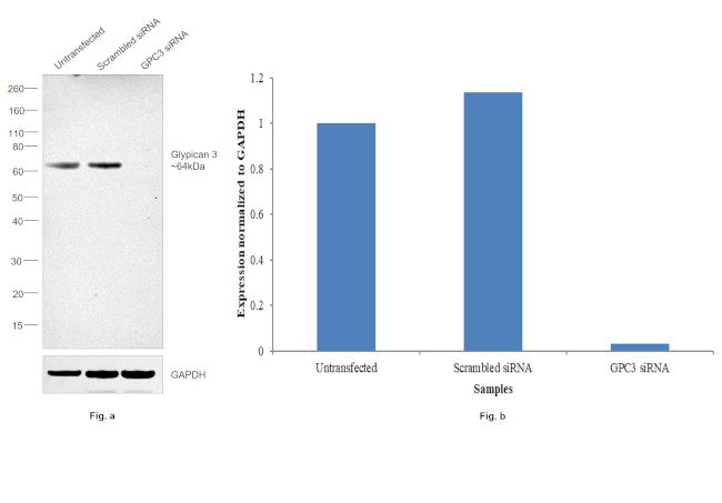 Glypican 3 Antibody in Western Blot (WB)