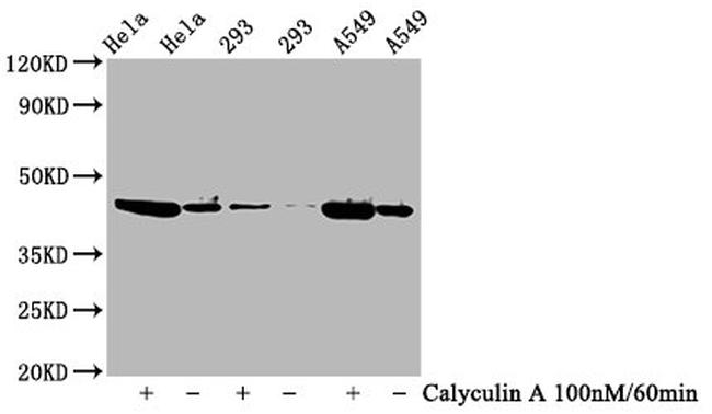 Phospho-GSK3B (Ser9) Antibody in Western Blot (WB)