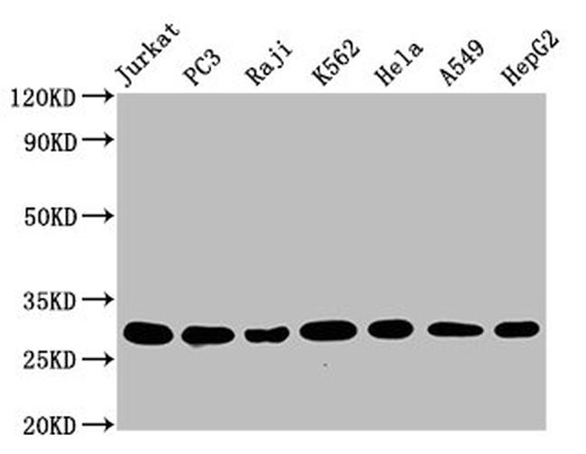 GST Omega 1 140A Antibody in Western Blot (WB)