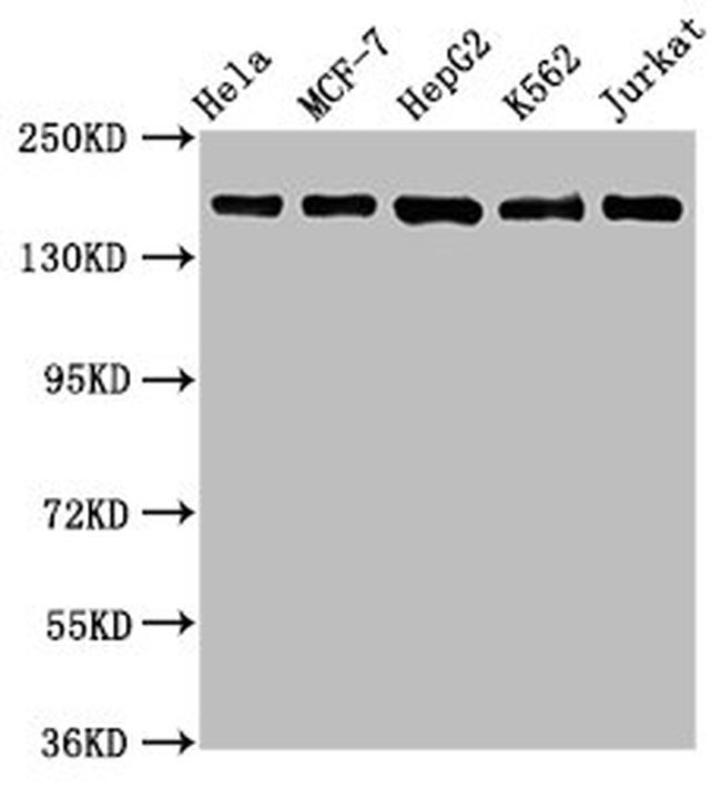 HDAC6 Antibody in Western Blot (WB)