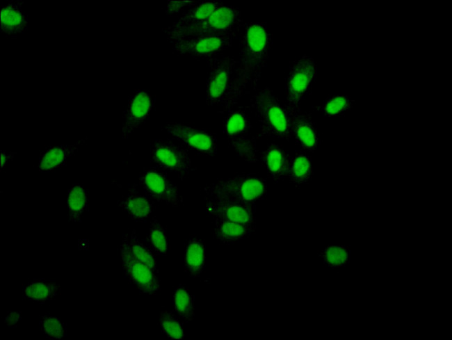 Histone H2A Antibody in Immunocytochemistry (ICC/IF)