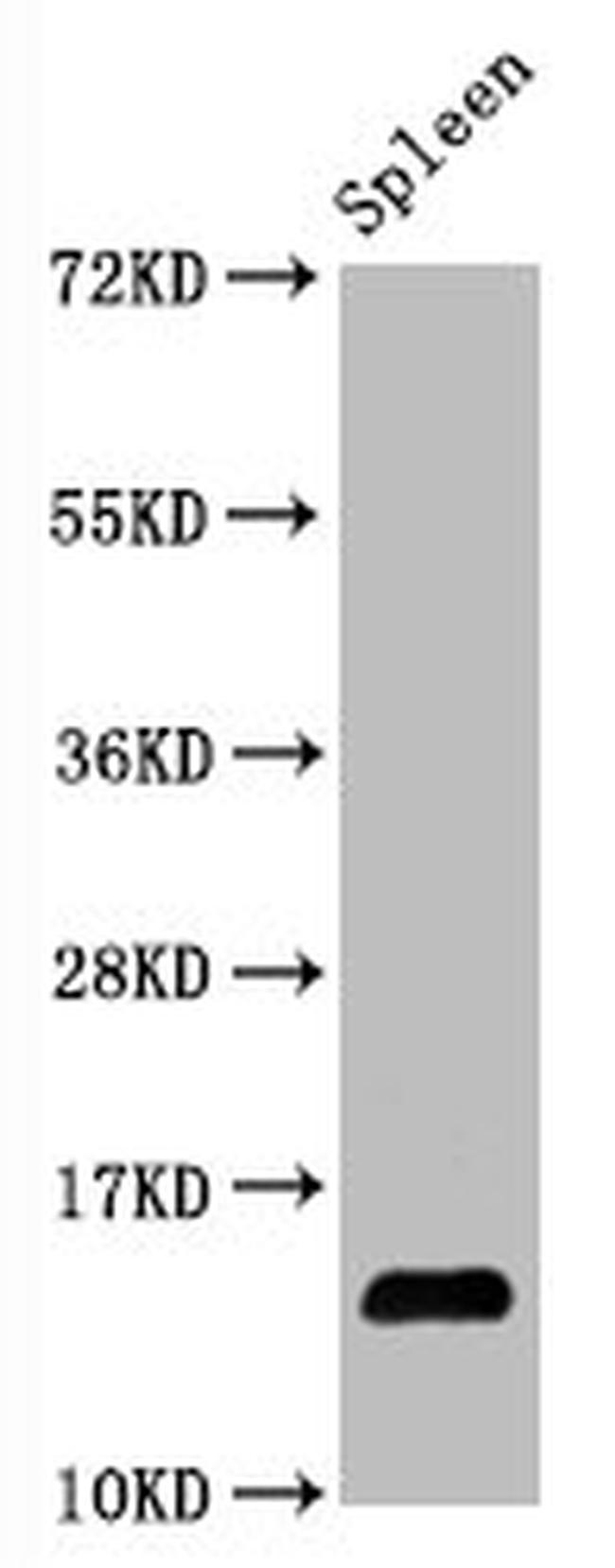 Hydroxyl-Histone H2A type 1-B/E  (Tyr39) Antibody in Western Blot (WB)