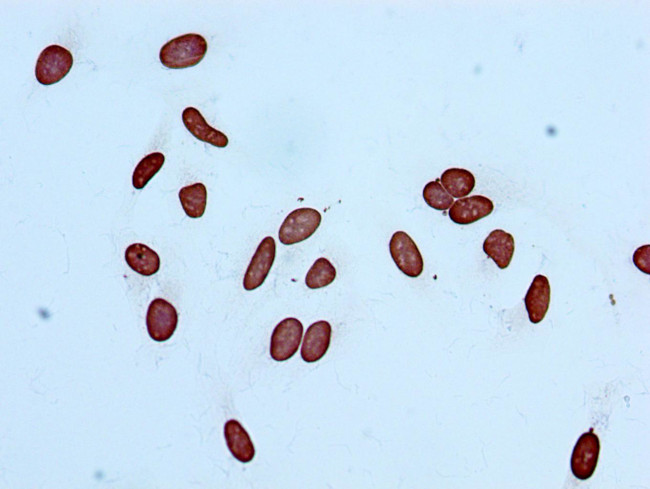 H3K14ac Antibody in Immunocytochemistry (ICC/IF)