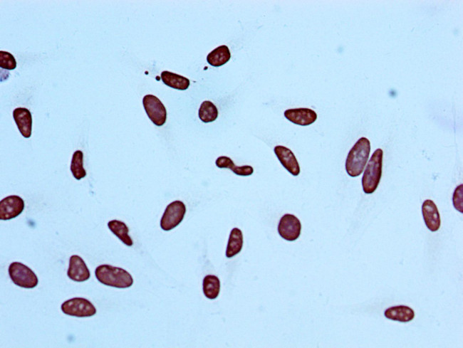 H4K5ac Antibody in Immunocytochemistry (ICC/IF)