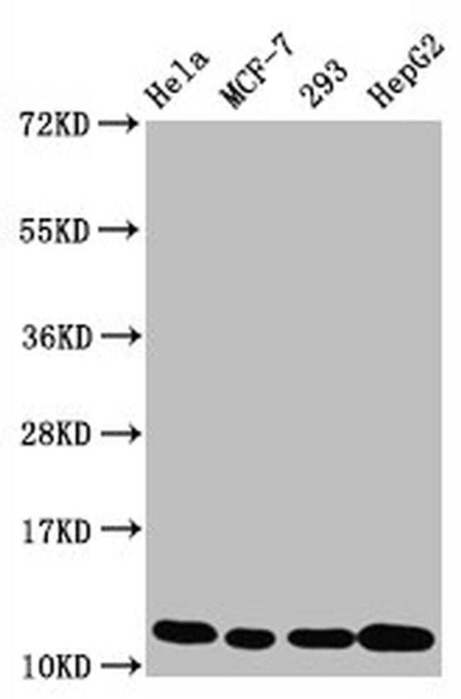 H4K5ac Antibody in Western Blot (WB)