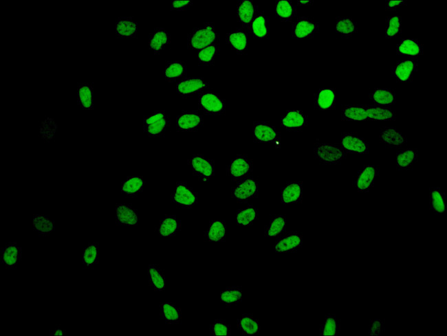 H4K16ac Antibody in Immunocytochemistry (ICC/IF)