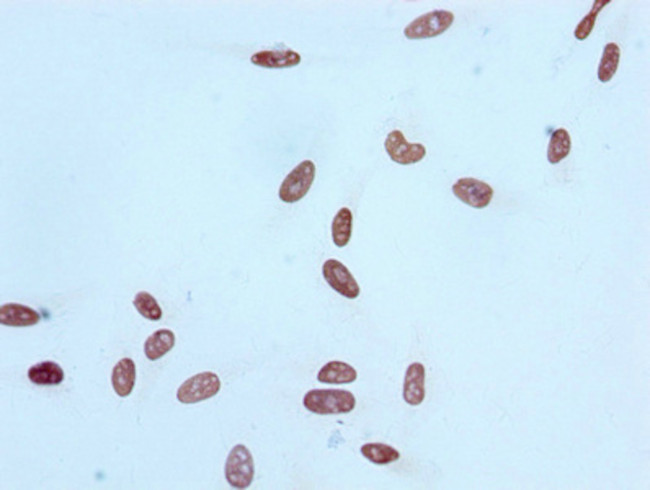 H4K16ac Antibody in Immunocytochemistry (ICC/IF)