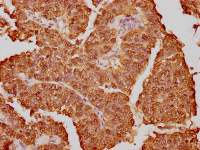 hnRNP K Antibody in Immunohistochemistry (Paraffin) (IHC (P))