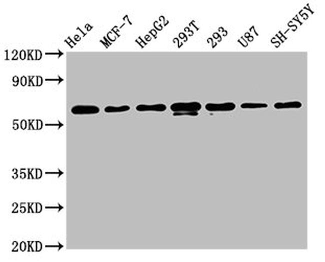 hnRNP K Antibody in Western Blot (WB)