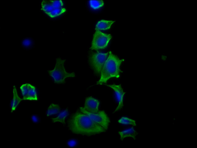 HSP27 Antibody in Immunocytochemistry (ICC/IF)